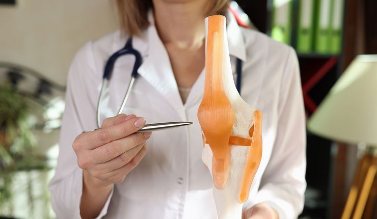 Medizinerin mit Knie-Modell